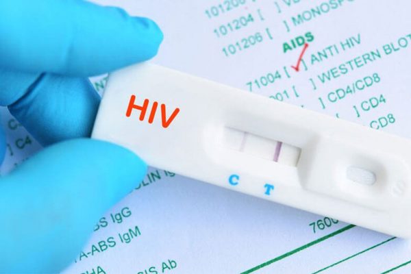 Các phương pháp xét nghiệm hiv tốt nhất hiện nay